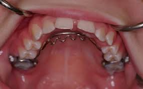 21042018042810037 251