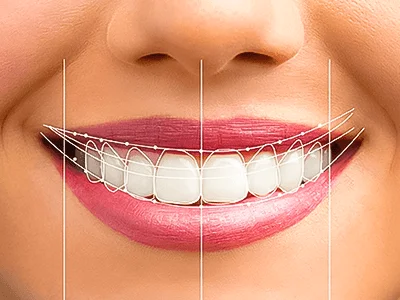digital smile designing delhi
